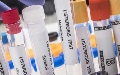 Designed a service for the rapid and simultaneous detection and quantification of  Listeria monocyogenes , Salmonella sp . and Shiga Toxin-producing Escherichia coli (STEC) in salmon processing plants.