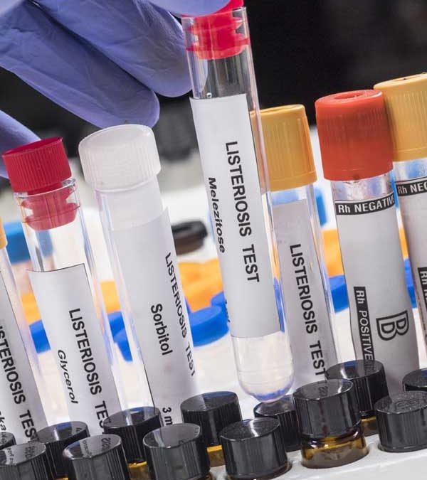 Designed a service for the rapid and simultaneous detection and quantification of  Listeria monocyogenes , Salmonella sp . and Shiga Toxin-producing Escherichia coli (STEC) in salmon processing plants.